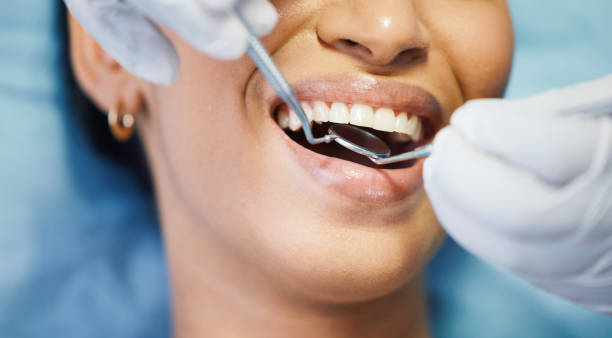 Best After-Hours Emergency Dentist in Philipsburg, MT